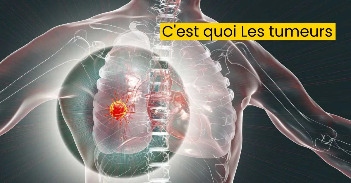 C'est quoi Les tumeurs